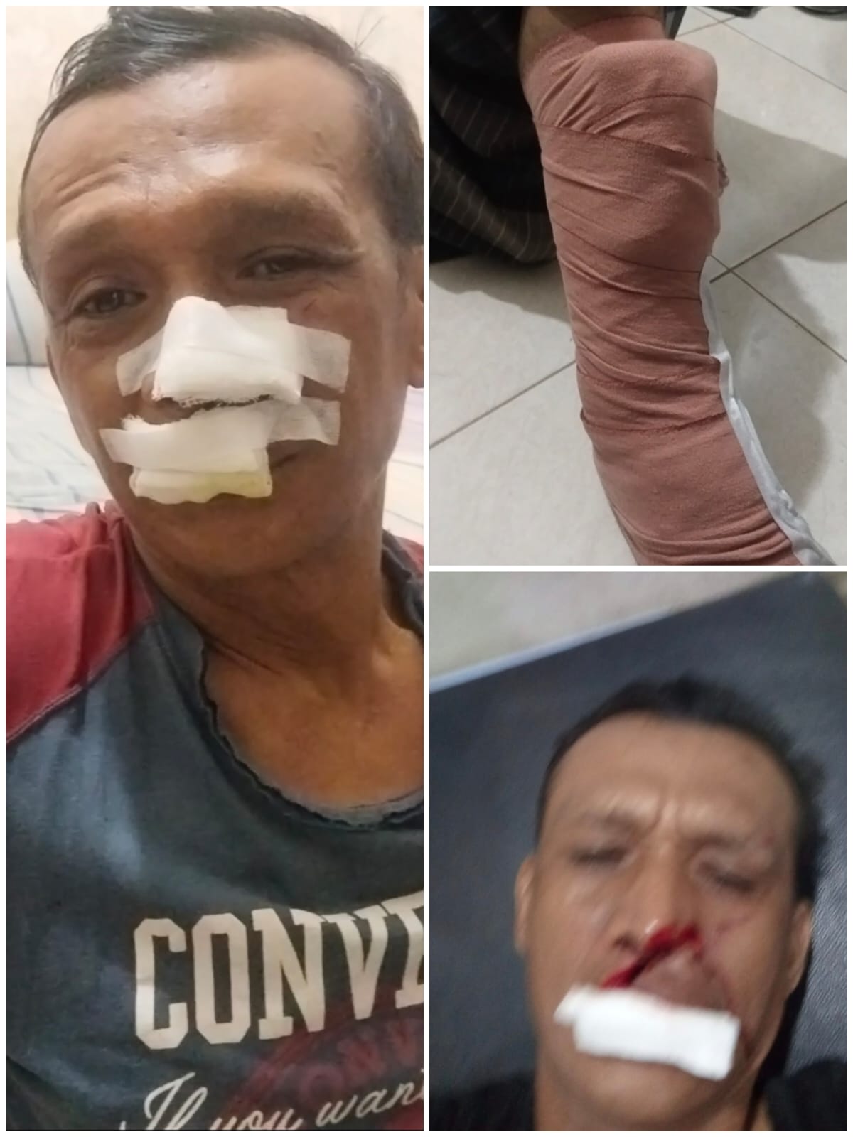 Dibacok Saat Hendak Beli Nasi Goreng, Ojol di Medan Perjuangan Minta Keadilan: Keluarga Desak Polisi Tangkap Pelaku